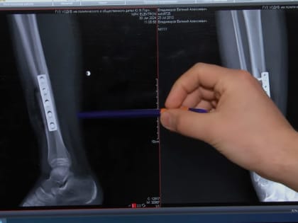 Будь здоров! 316 выпуск. Эпидемия травматизма