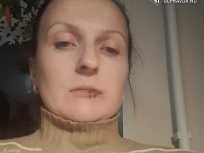 Разорвали губу, повредили челюсть и зубы. В ульяновской стоматологии изуродовали пациентку