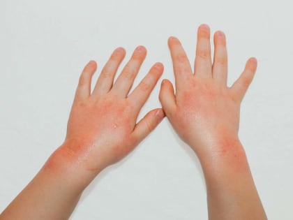 Сезон бассейнов: советы по безопасности для детей