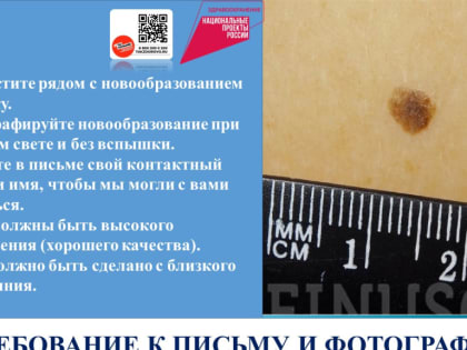 Специалисты городской поликлиники № 1 им. С.М. Кирова предлагают проверить «подозрительные» родинки