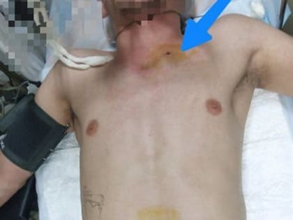 Военный хирург Кучиц спас бойца СВО