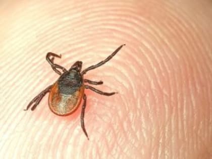В Ульяновской области за неделю клещи покусали 78 человек