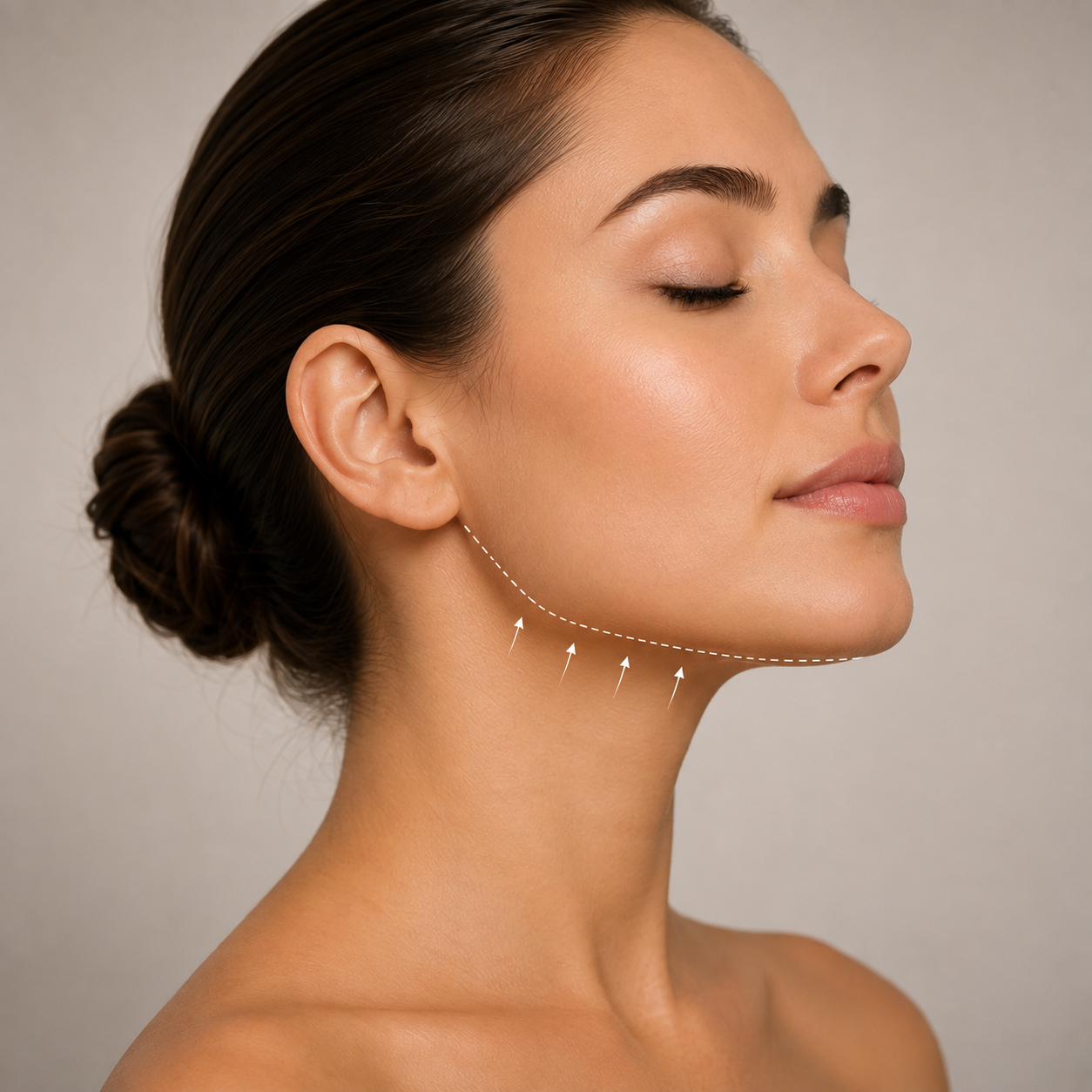 Perfilado Mandibular