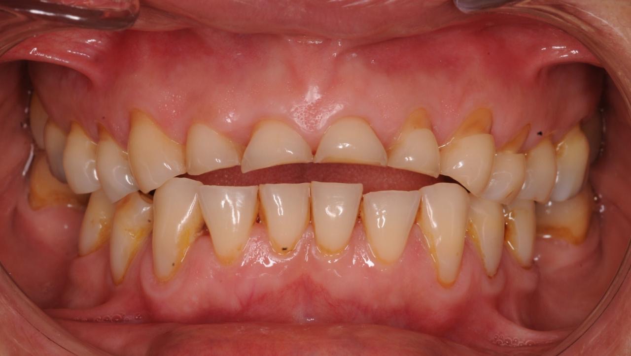 Sonrisa antes del tratamiento, caso Forma