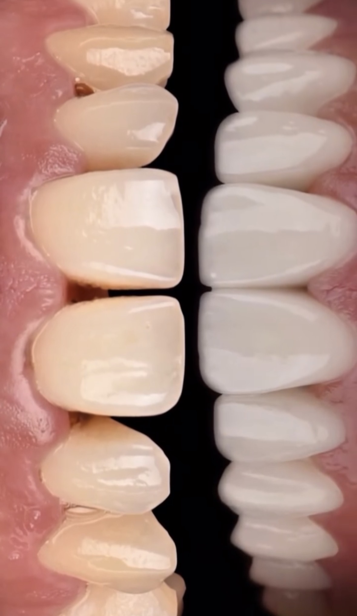 Dr. Tomás Allende, rehabilitador oral de Dental Vitacura