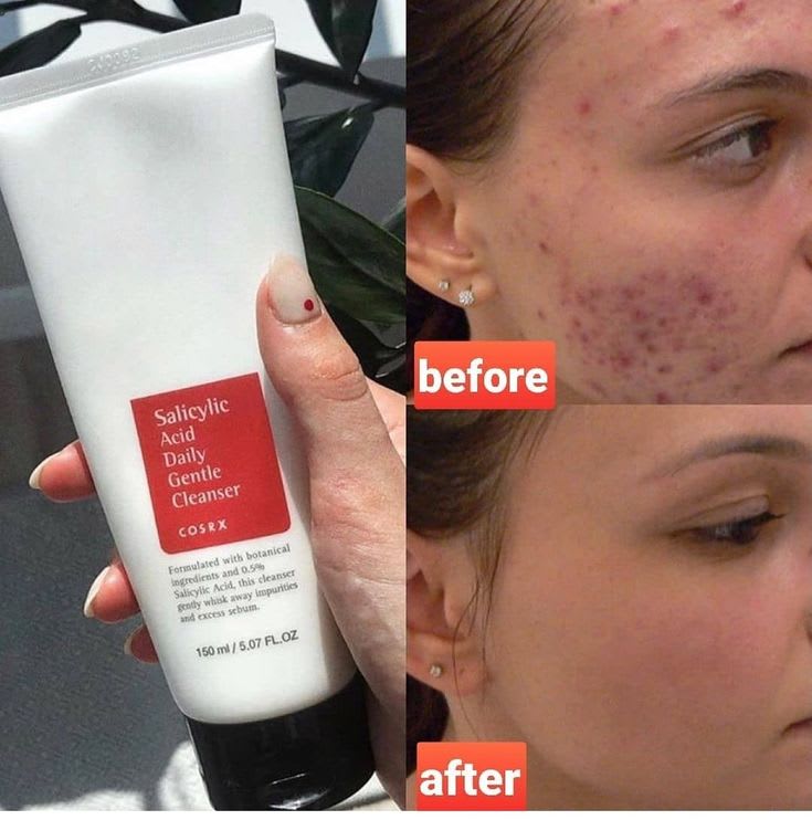 COSRX Salicylic Acid Daily Gentle Cleanser