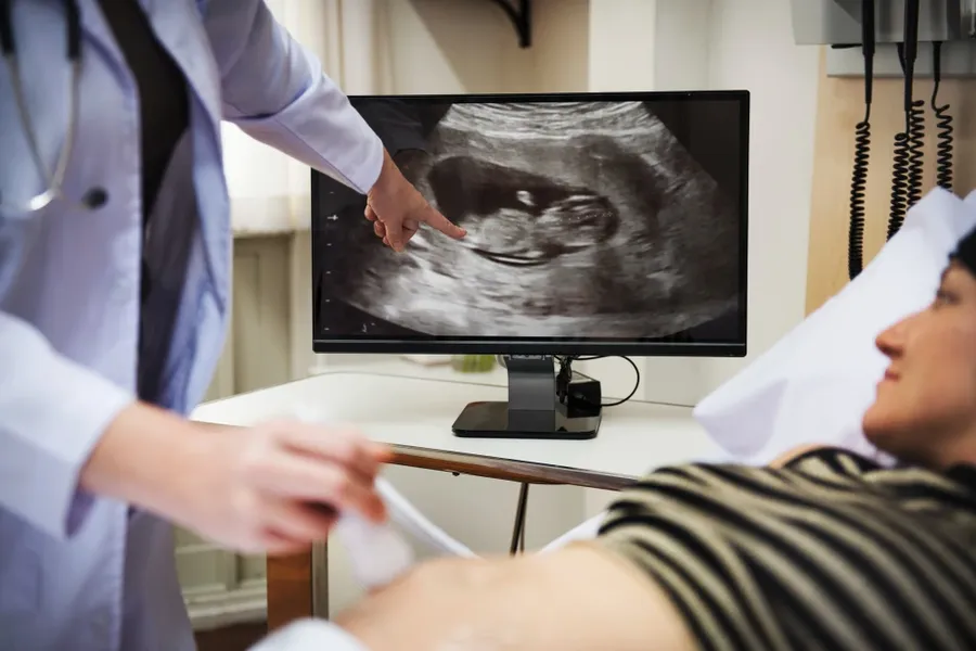 Safe Medical Imaging Without Radiation: Ultrasound Services at Your Center