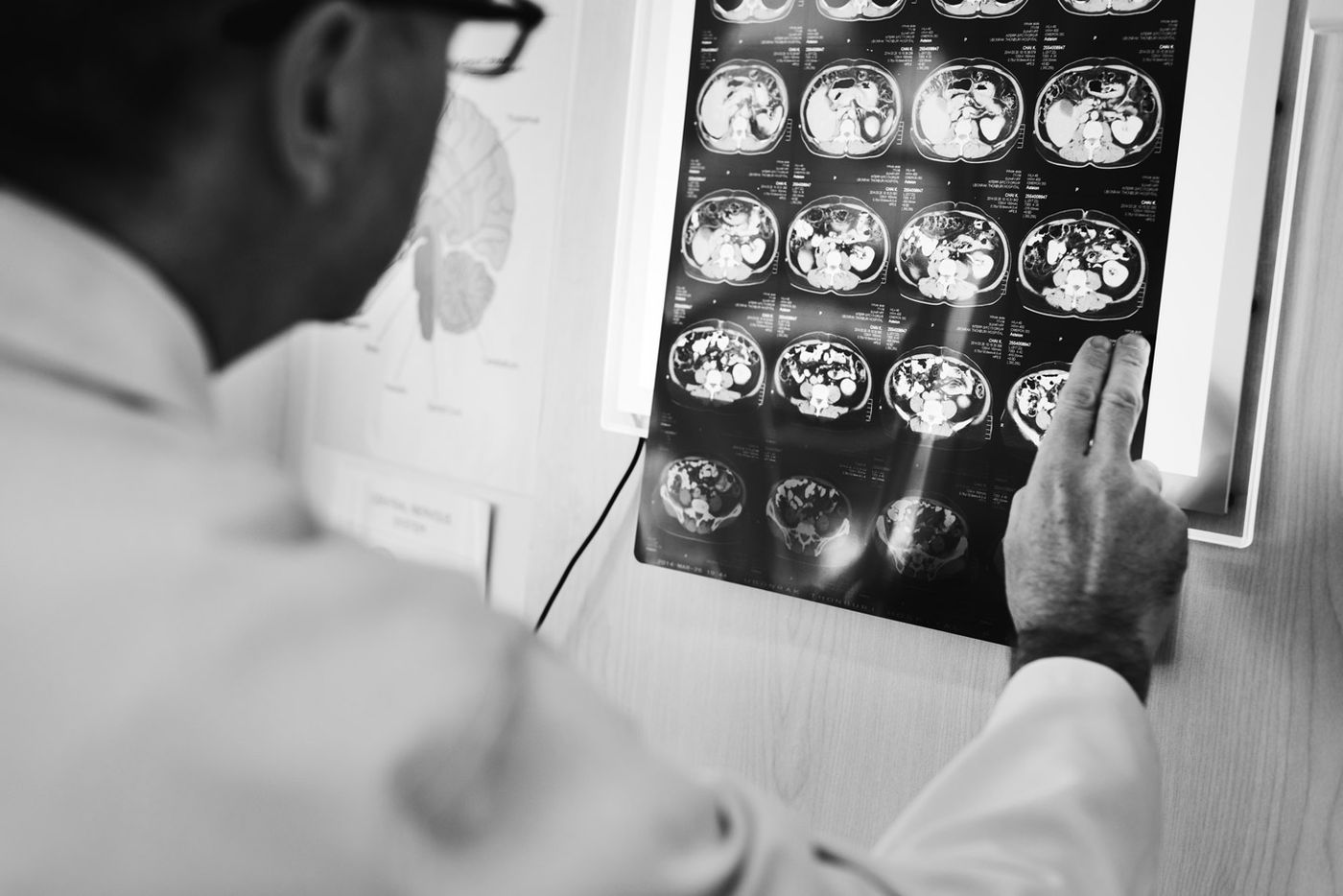 How to Choose the Best MRI Scan in Calicut: A Complete Guide