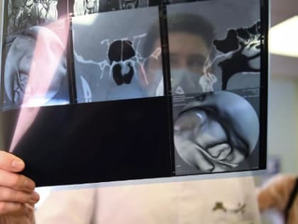 Онколог назвал самые распространенные виды рака у россиян