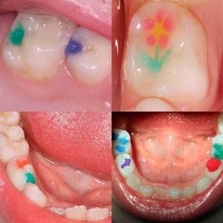 jen-rainbow-kid-kit-kolorovyi-flow-kompozyt2