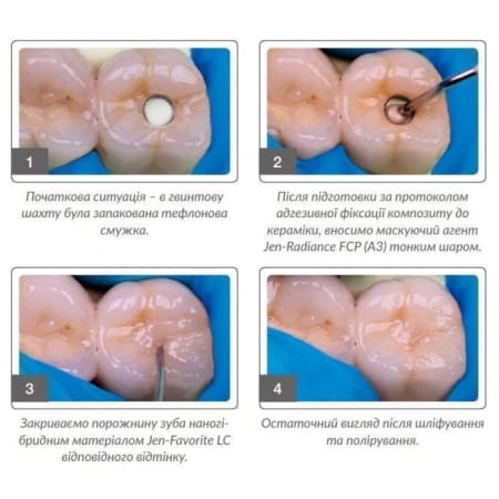 jen-radiance-fcp-barvnyk-kompozytnyi-3g2