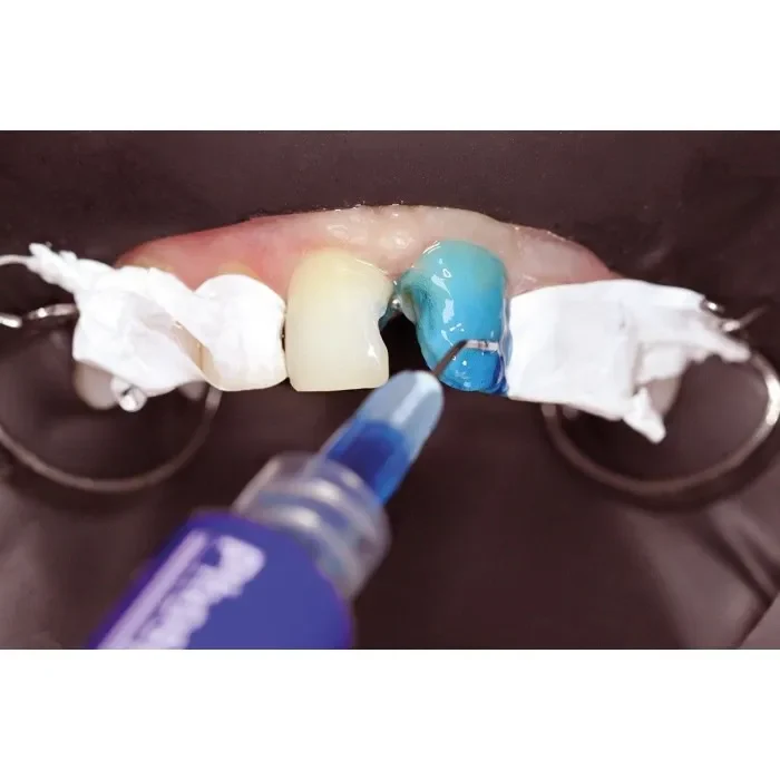 Травильний гель (37% ортофосфорної кислоти з антисептиком) Phospho-Jen AS (Фосфо-Джен AS) (Джендентал-Україна)