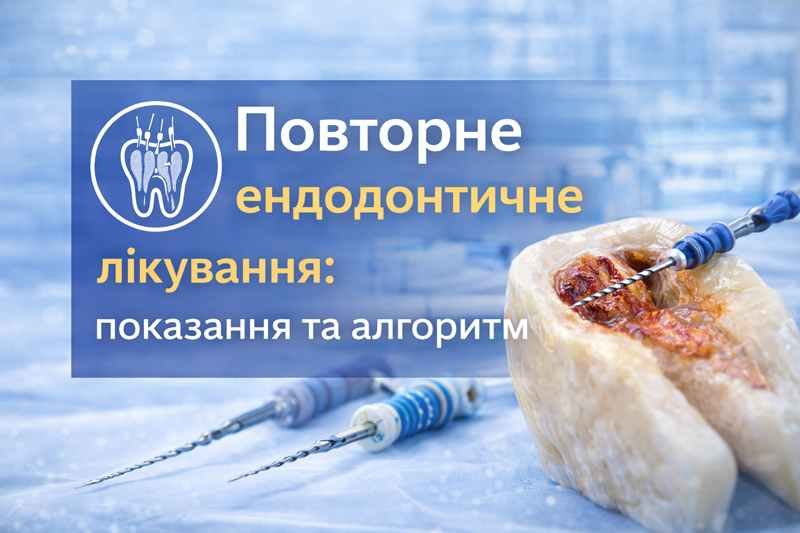 Повторне ендодонтичне лікування – дезобтурація кореневого каналу та робота ендодонтичним інструментом compressed