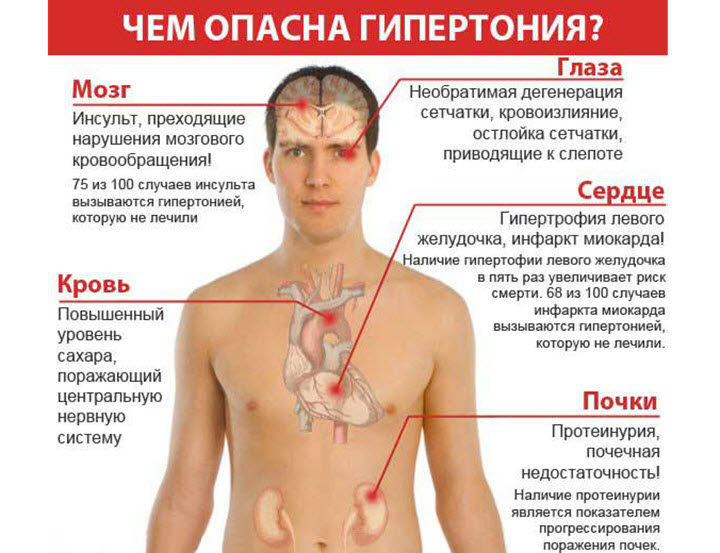 ГИПЕРТОНИЯ . СИМТОМЫ ,ДИАГНОСТИКА И ЛЕЧЕНИЕ.