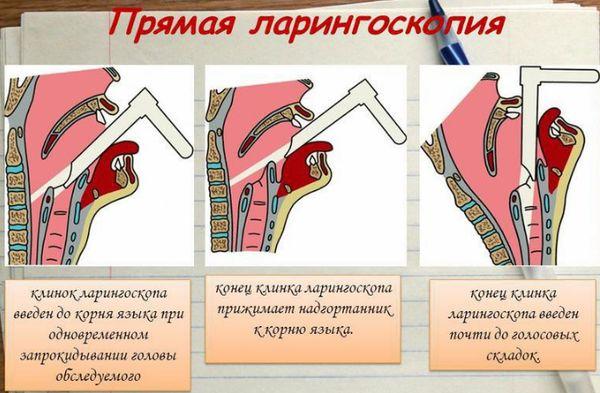 Эндоскоп в нос
