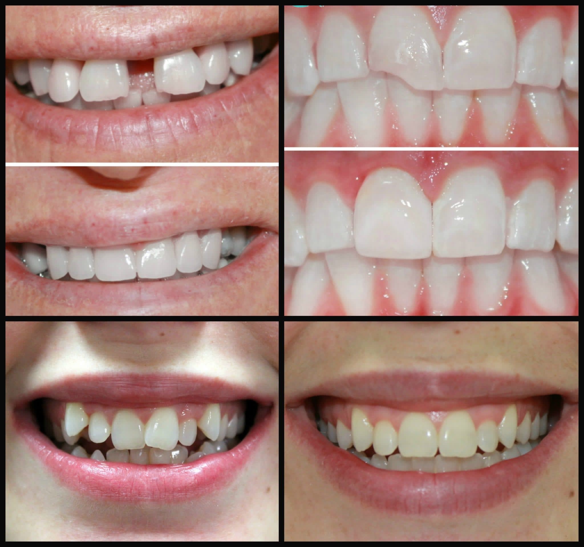Aesthetic Dentistry