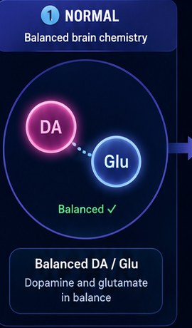 Panel 1 — Normal: balanced brain chemistry, dopamine and glutamate in balance