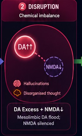 Panel 2 — Disruption: chemical imbalance, mesolimbic DA flood and NMDA silenced, hallucinations and disorganised thought