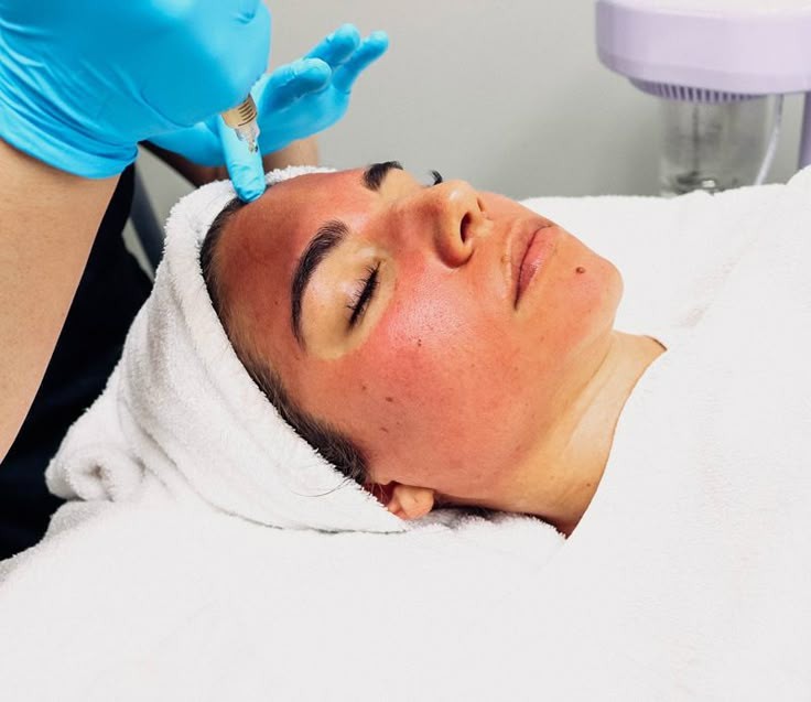 Fillers & Injectables