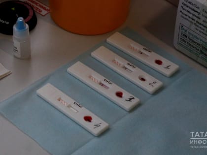 «Человек либо в шоке, либо отрицает новость»: почему проверяться на ВИЧ нужно постоянно?