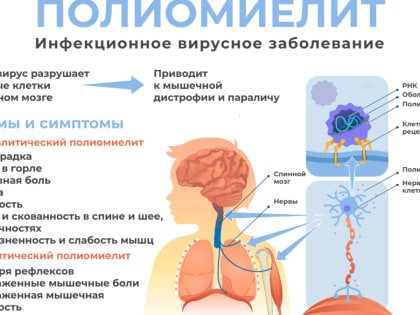 Роспотребнадзор напоминает о профилактике полиомиелита