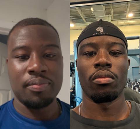 Transformation 39