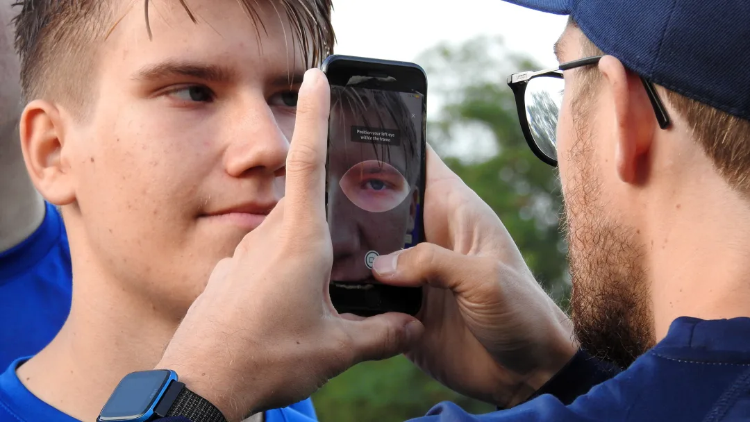 Ny studie undersöker pupillens roll vid diagnos av hjärnskakning - SWE3 thumbnail