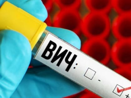 Три сибирских региона вошли в число лидеров по заболеваемости ВИЧ