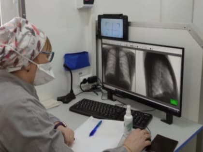 Новосибирцев зовут проверить свои легкие в преддверии всемирного дня борьбы с туберкулезом