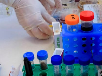 Средство против ВИЧ на основе чаги придумали под Новосибирском