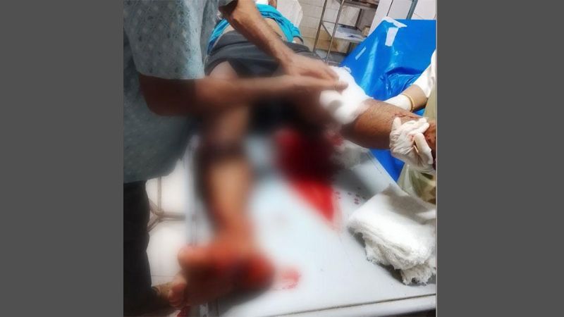 লোহাগাড়ায় যুবককে এলোপাতাড়ি কোপাল এক রোহিঙ্গা