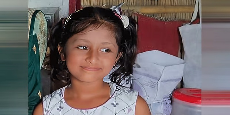 মিয়ানমারের গুলিতে আহত শিশুর মাথার খুলি খুলে রাখা হয়েছে, বসছে মেডিক্যাল বোর্ড