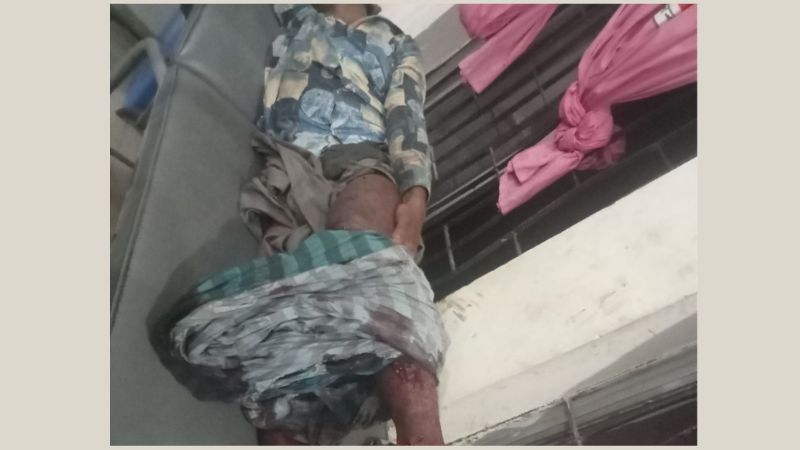মিয়ানমার সীমান্তে মাইন বিস্ফোরণে বাংলাদেশি যুবকের পা বিচ্ছিন্ন