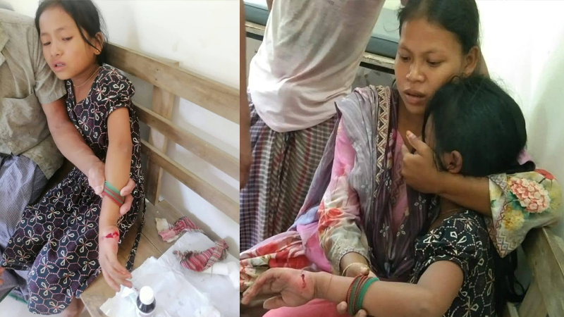 সাজেকে ইউপিডিএফ-জেএসএসের আধিপত্যর লড়াইয়ে শিশু গুলিবিদ্ধ