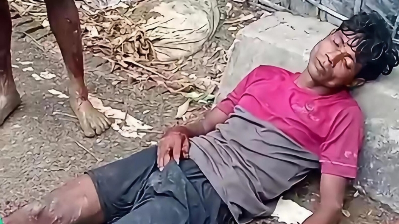 মিয়ানমার সীমান্তে আরাকান আর্মির পুঁতে রাখা স্থলমাইন বিস্ফোরণে রোহিঙ্গা যুবক আহত