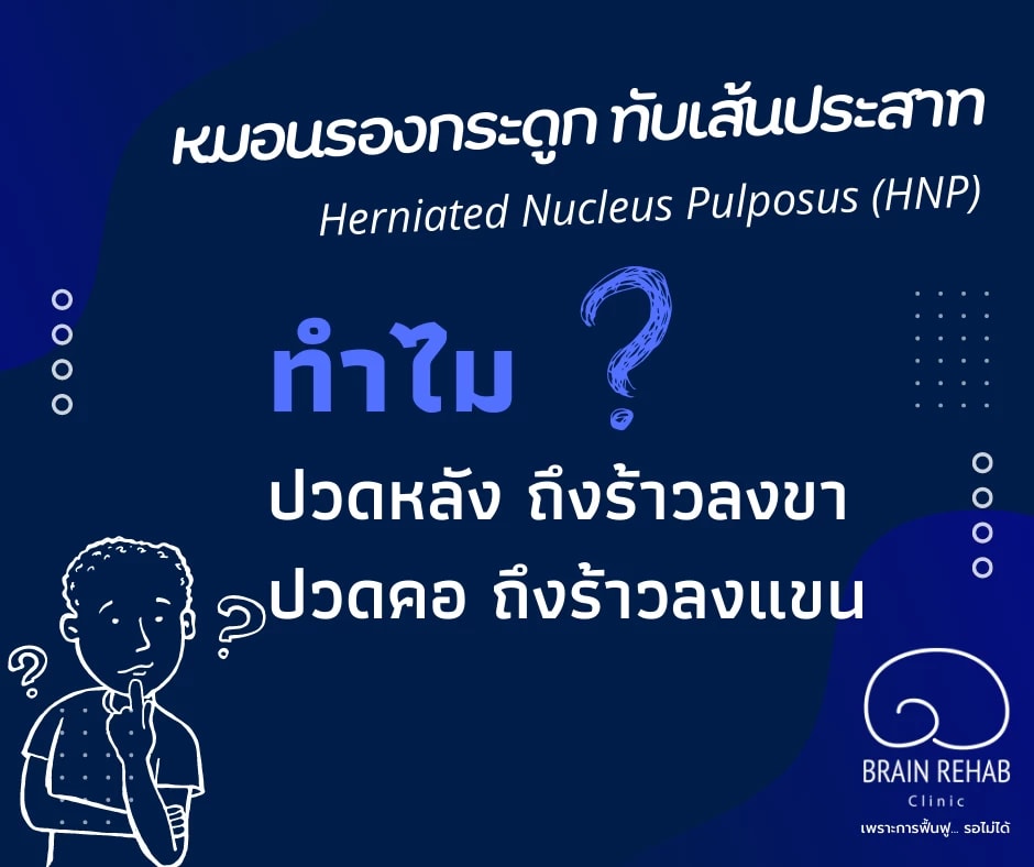 หมอนรองกระดูกทับเส้นประสาท (HNP) | สาเหตุ อาการ การรักษา