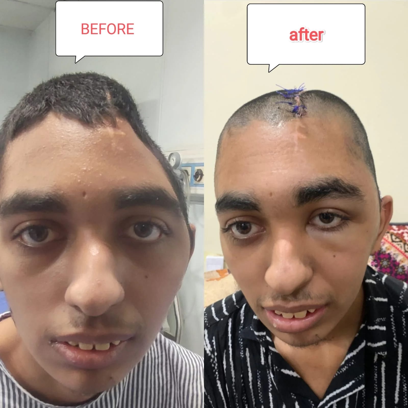 Patient journey 2, shared with consent