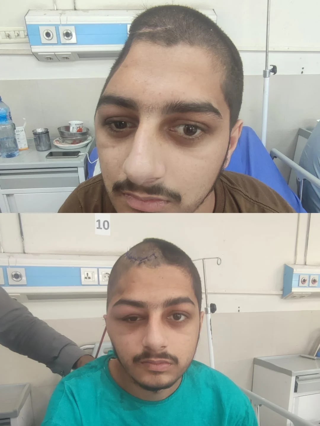 Patient journey 4, shared with consent
