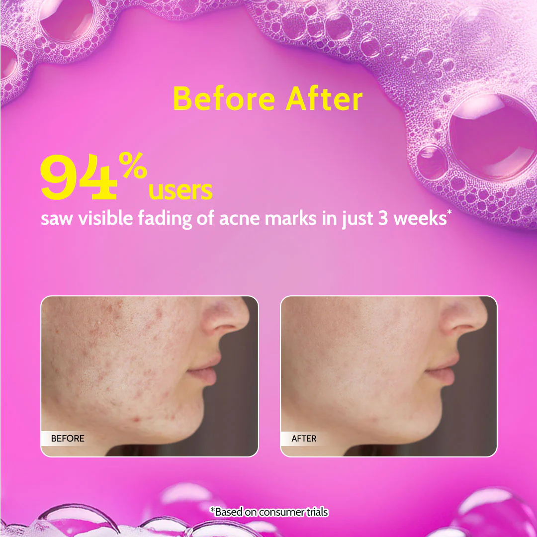 Chemist at Play Face Wash (100 ml) price in Nepal-3