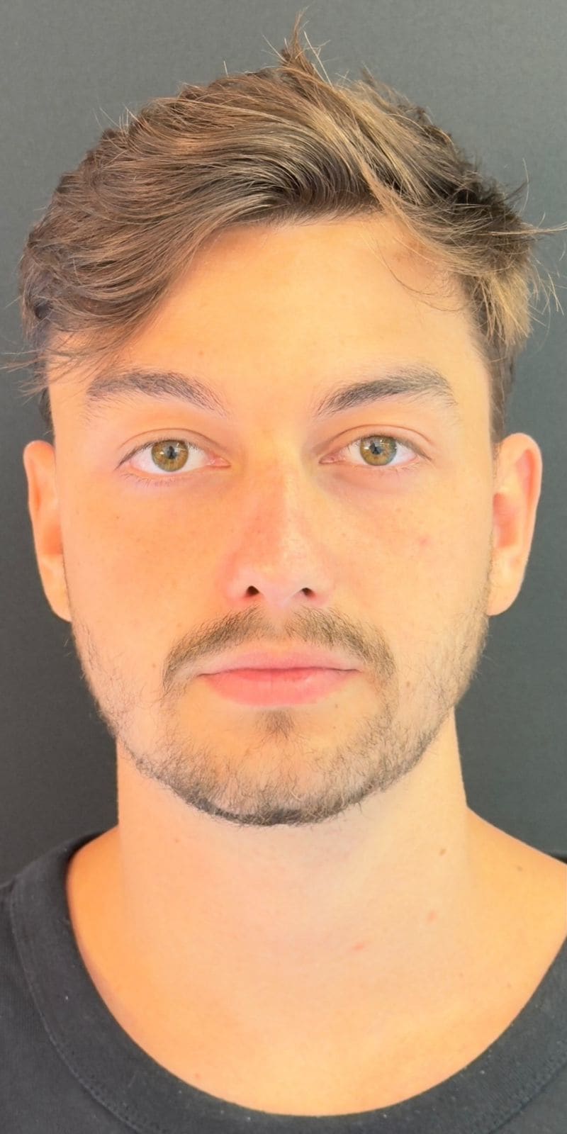 Homem de frente, antes do procedimento, em fundo cinza uniforme