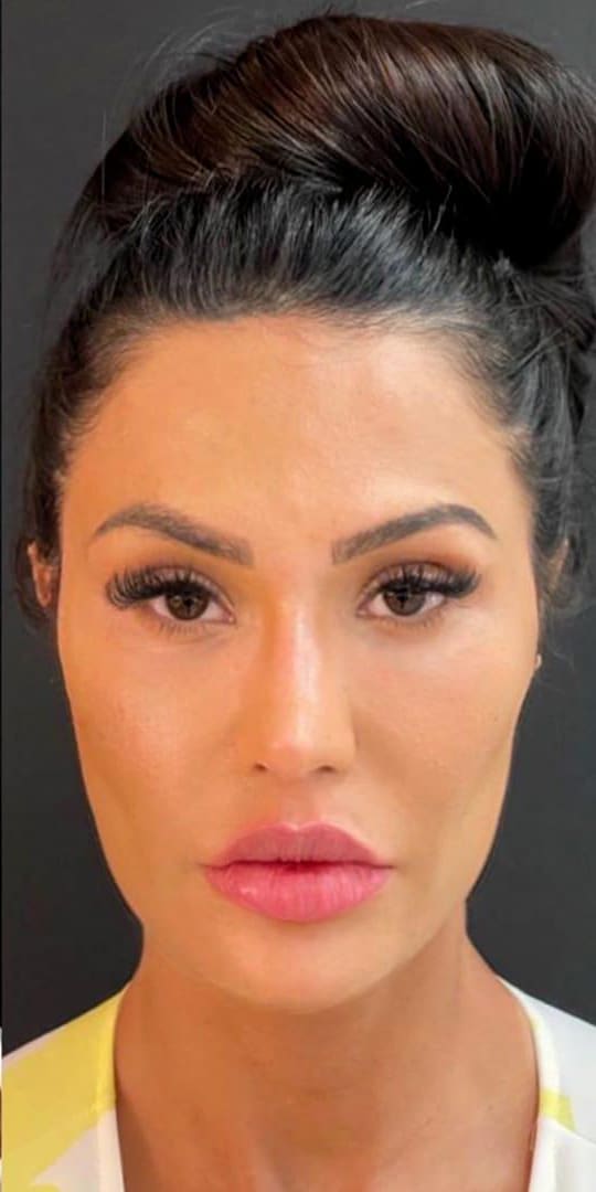 A mesma mulher de frente, depois do procedimento, com cabelo preso e maquiagem