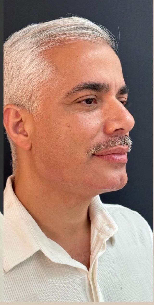 Registro depois do procedimento