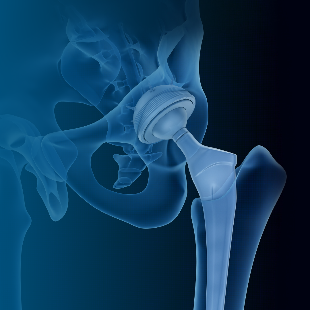 image de la carte CAS HES-SO in Clinical Affairs, Regulatory and Quality for Medical Devices and In-Vitro Diagnostic (CARAQA)