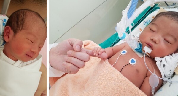 故 정아영(3) 양이 4명의 또래 아이들에게 새 생명을 선물하고 세상을 떠났다.  ©한국장기조직기증원