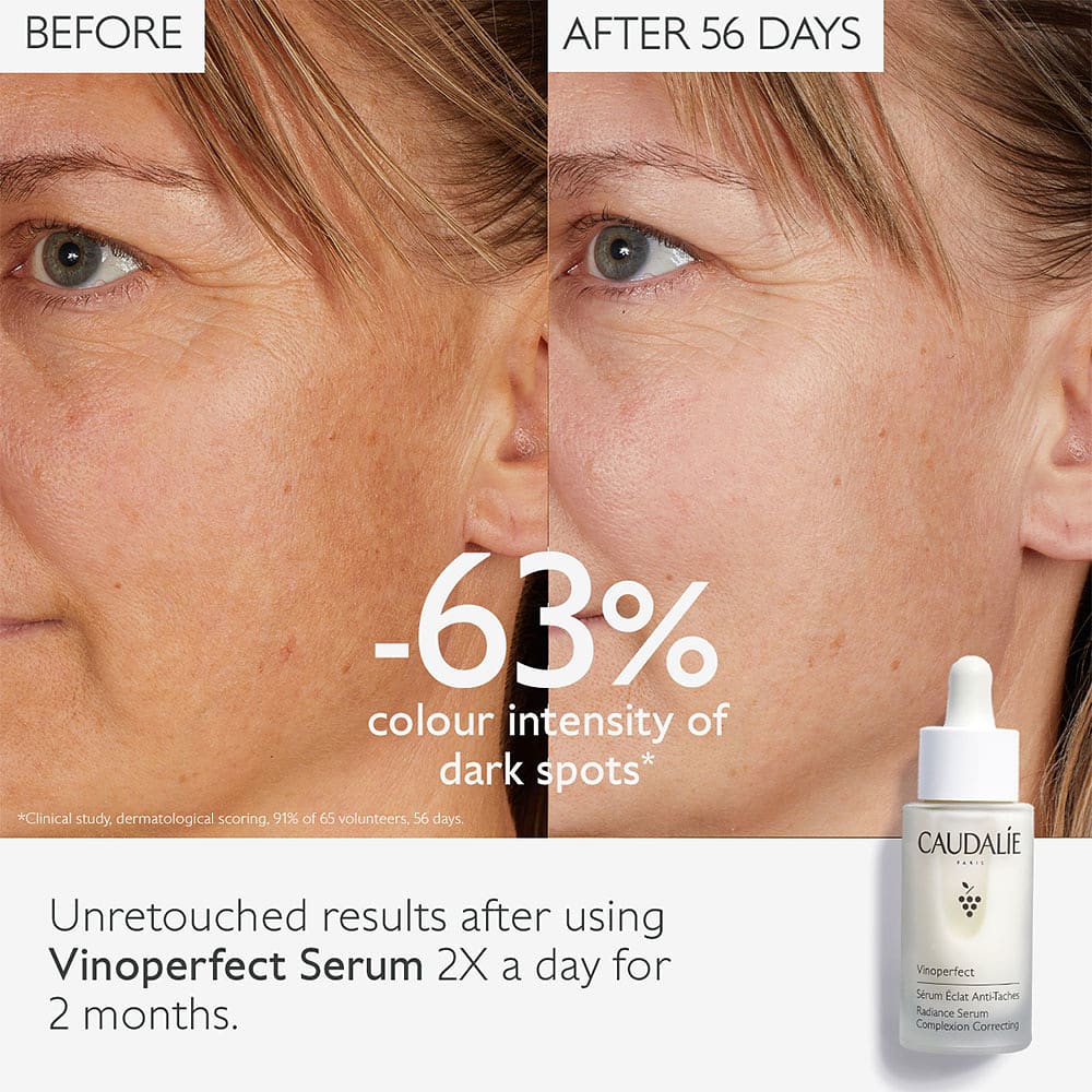 Vinoperfect Radiance Serum Complexion Correcting