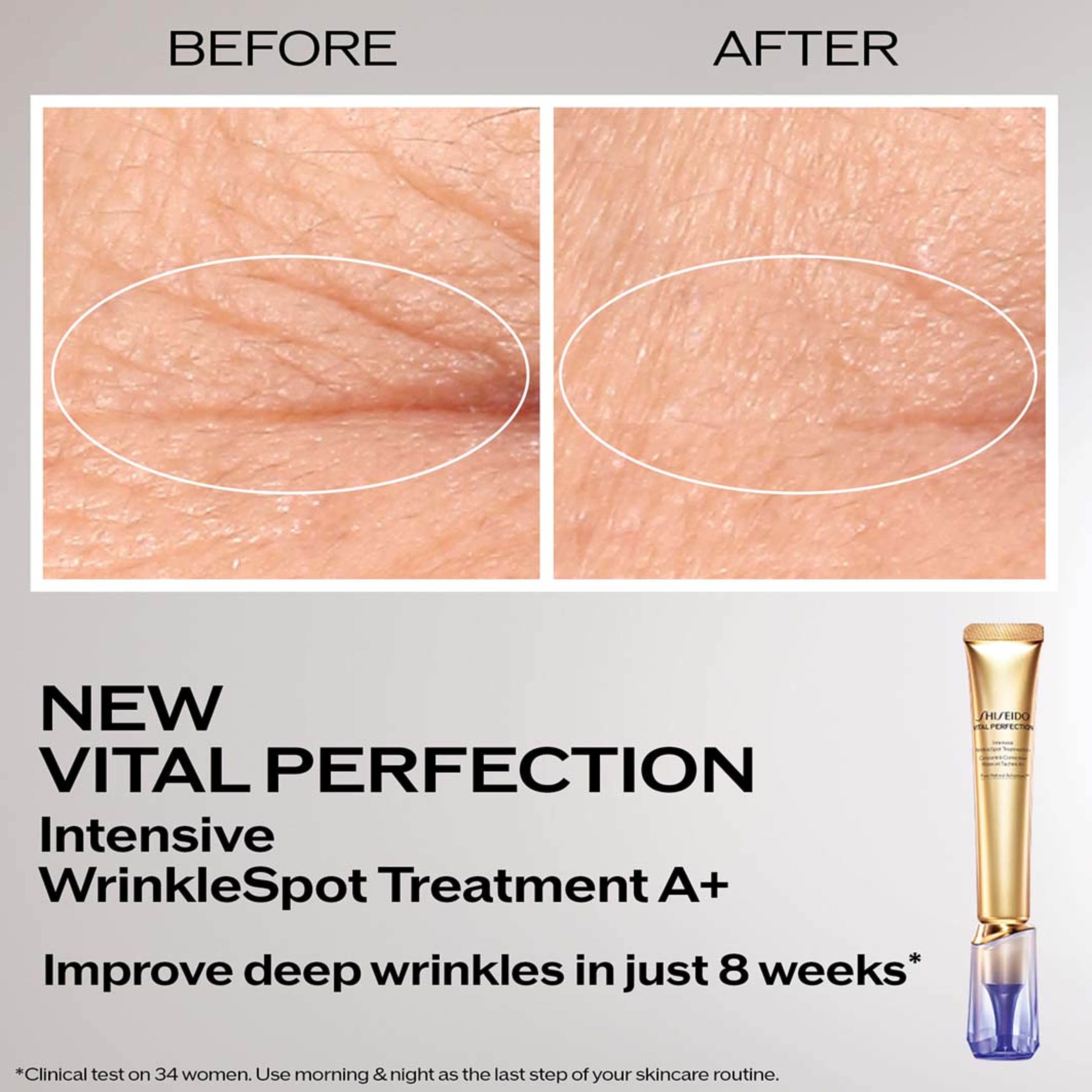 Vital Perfection Intensive Wrinklespot Treatment A+, från Shiseido. Klicka för att öppna bilden i stort format