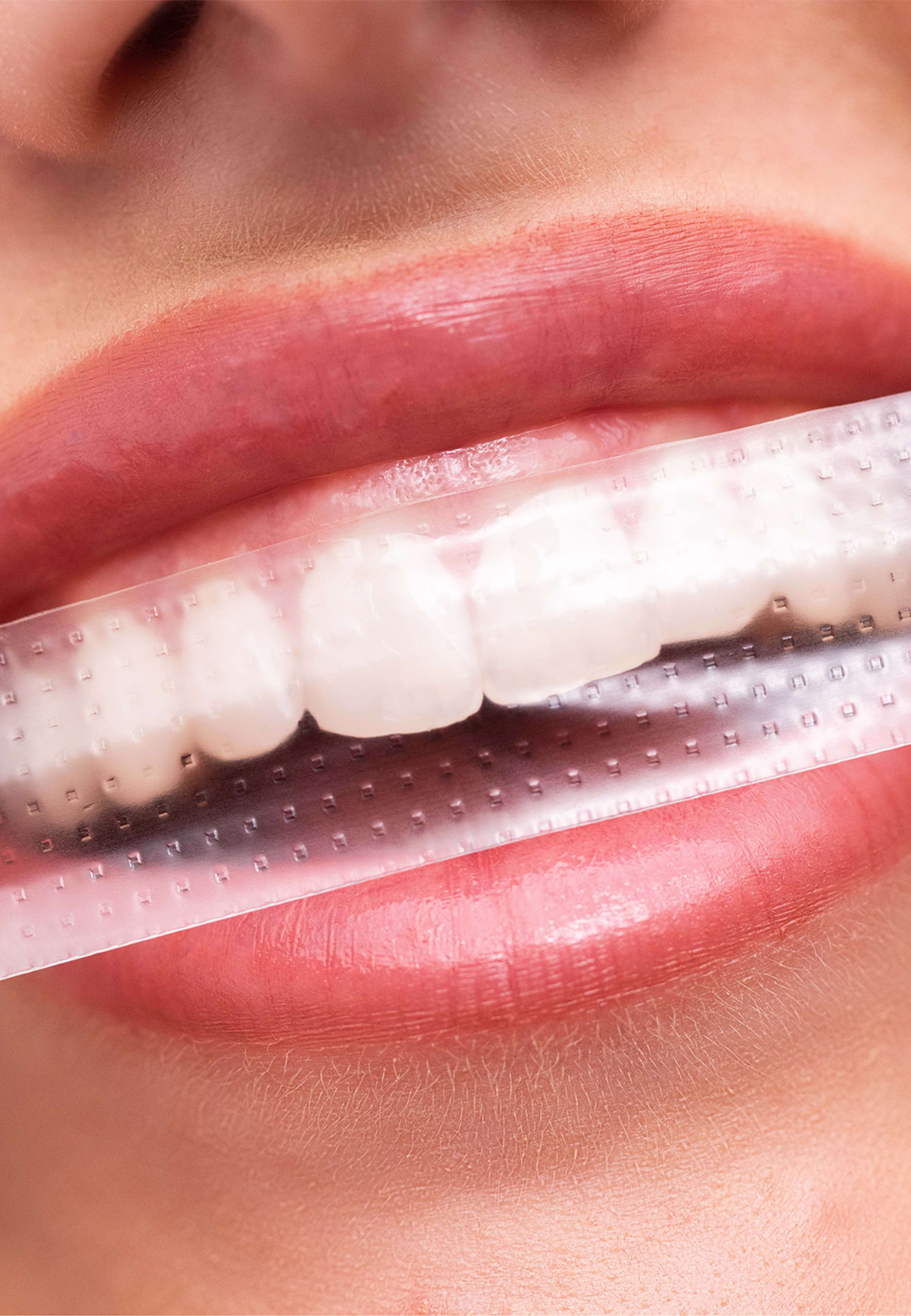 PAP+ Whitening Strips