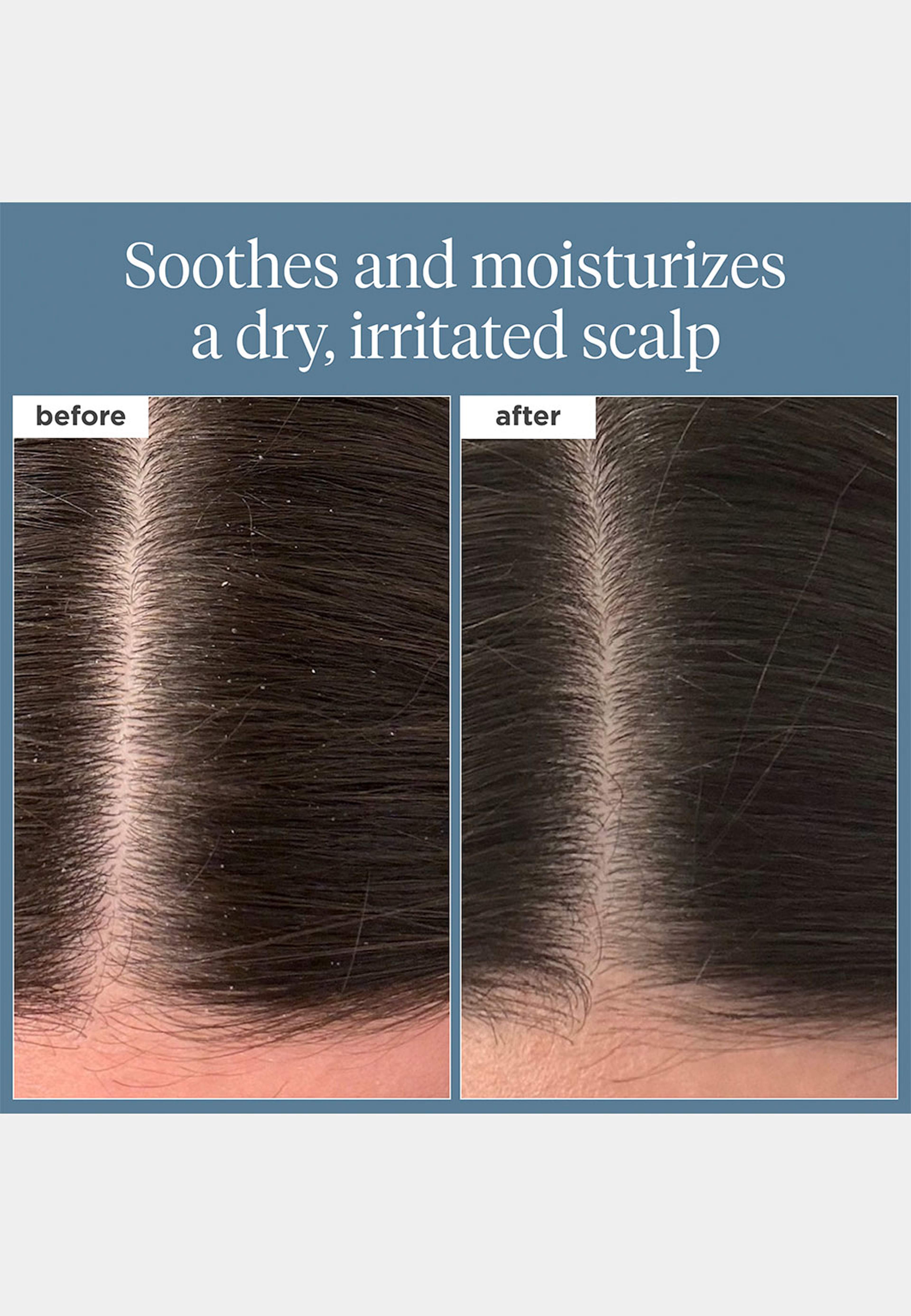 Scalp Revival™ Rosemary Pre-Wash Oil