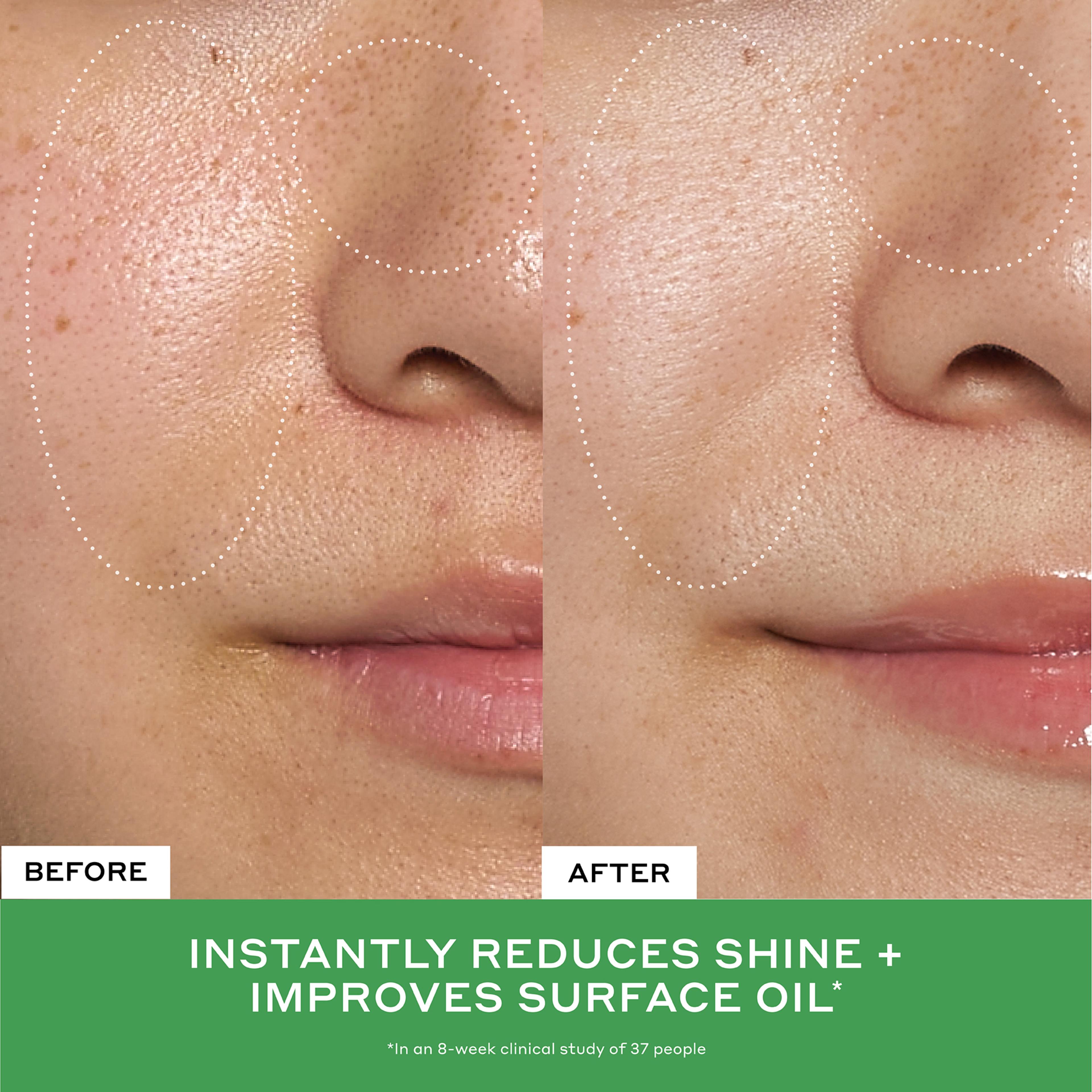 Detox Drops 2% Salicylic Acid Toner