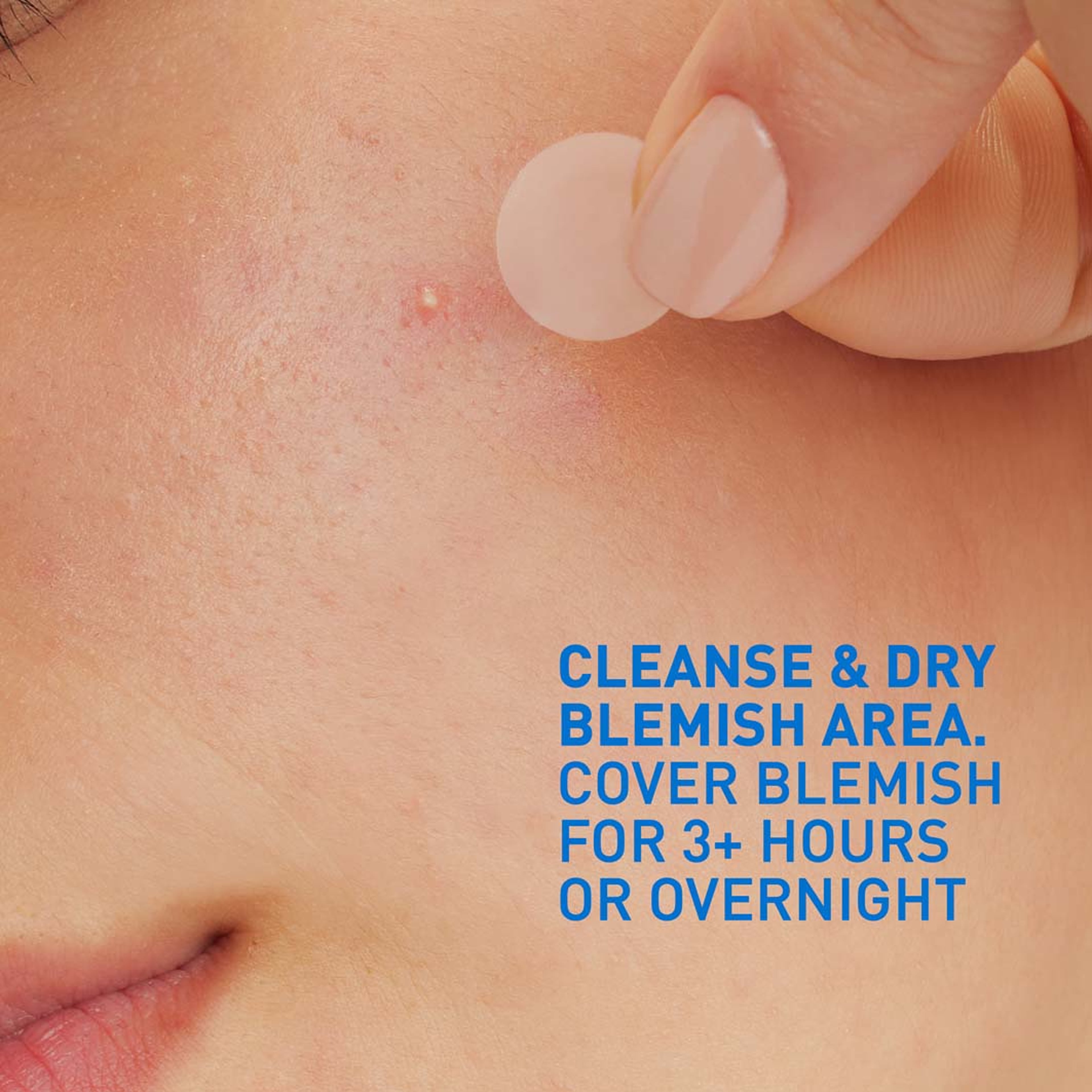 Blemish Barrier Patches, från CeraVe. Klicka för att öppna bilden i stort format